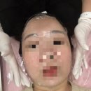 블리홍