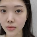 안동로 네이버블로그
