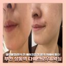 상동제2경로당 | 부천 상동왁싱 다비브로우&amp;왁싱 인중왁싱 솔직후기