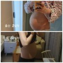 이지현내과의원 | 삼성미즈에서 둘째 출산&amp;조리원 후기예요^^