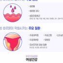 부정출혈 원인 (피임약, , 임신, 혈색) 이미지