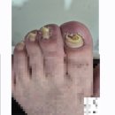 세븐일레븐 영천완산중앙점 | 영천에서 네일 정리하고 알게 된 미애뷰티, 문제성 발관리로도 알려진 곳