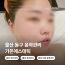 울산 동구 윤곽관리 가온 에스테틱 비대칭 두골비 1회차 후기