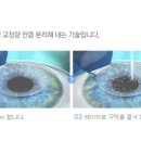 강남조은눈안과의원 이미지