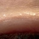 컴포트성형외과의원 이미지