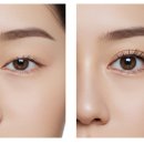 루아크성형외과의원 이미지