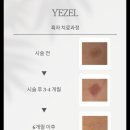예젤의원 네이버블로그
