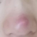 비에이성형외과의원 이미지