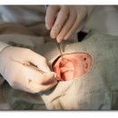 미소인치과기공소 이미지