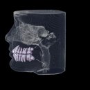 열린치과기공소 이미지