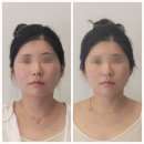 피부미인 관리실 | 부산 서면체형관리 서면피부관리 추천 피부관리실 미인 두골비 두골체 후기