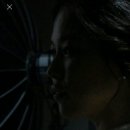 청미의원 | 청미의원 필러 7년 뒤 후기