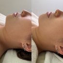 주식회사 이지헬스케어 | [평택/고덕] 평택윤곽관리후기 평택에스테틱 평택여드름관리 로즈아트스킨 이지다 "찐후기"