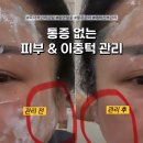 고운동_고운프라자 | 세종 리프팅 이중턱 완벽케어 / 1번으로도 즉각적인 효과 / 고운동 리프레시 피부관리 추천