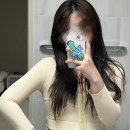 중앙대로1L | 양산지방흡입 뚱땡이 팔뚝지흡 5주차 상세후기 푼다(4편)