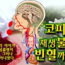 코피에서 재생불량성 빈혈까지 - 면역기능이 매우 낮습니다, 평소 예방이 최선입니다. 이미지