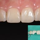 굿모닝뉴욕치과의원 이미지