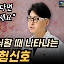 아차! 하면 놓치기 쉬운, 암이 보내는 5가지 신호 꼭 알아두세요. 알아차리기 어려운 암의 초기 증상들. 이미지