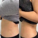 세븐일레븐 부산전포몽뜨레점 | 부산 전포 전신관리 서면 미리퓨어 에스테틱 TNT 복부관리 솔직후기