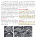 5마리의 개와 1마리 고양이에서의 Choroid plexus가 involve된 CNS lymphoma의 MR finding 이미지