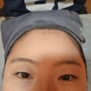 위드 비비드 뷰티샵 | 광주 봉선동 피부관리 '위드비비드뷰티샵' 에스테틱 울써마지 내돈내산 후기! 모공 요철·속건조·탄력...