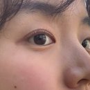 단미에스테틱 네이버블로그