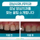 사과나무치과의원 | 강남 사과나무치과의원이 대표 양심치과로 선택 받는 이유