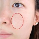 (주)아이디플라코스메틱 | MTS롤러 앰플 추천 아이디플라코스메틱 엑소브이 프로리프팅으로 모공케어 찐후기