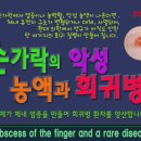 손가락에서 나오는 악성 농과 희귀병의 원인과 치료. 이미지
