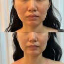 동안노인교육센터 | 의정부 호원동피부관리 가꾸는동안&amp;숲칼프 의정부교육센터 관리 후기