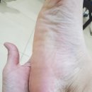 지니스네일