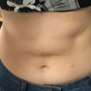 신진약국 | 삭센다주사약국 처방 방법, 내돈내산 다이어트주사 솔직후기