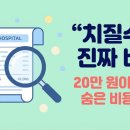 하이닥의원 | 치질수술 비용 본인부담 20~34만 원이면 끝? 포괄수가제 적용 구조와 추가비용 팩트 체크