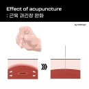 척척마디한의원 이미지