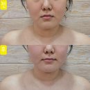 휠로스인약손 | 치평동체형관리 맛집 슈퍼보습관리 휠로스인 약손 후기
