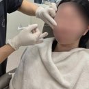 신사-113 | 신사보톡스, 3번 맞고서야 알게 된 사실