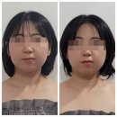 [목동/화곡]목동 피부관리 쏘영피부연구소 두골비 후기