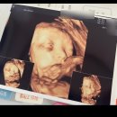 밝은마음정신과의원 | 소아과, 조리원 다 있는 주치의 분만제 밝은미래산부인과의원 리뷰