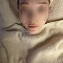 대구뷰티샘 - 달서구 당산로 81 | 대구 신매역 피부관리 추천 리주비스킨앤왁싱 ✨ 멜라소닉토닝 + 듀얼리프팅 3000샷 후기