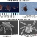 참진드기 ㅡ쯔쯔가무시 털진드기 보다 더 독함 이미지