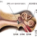 좋은소리 보청기 이미지