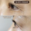 국제K뷰티협회/K뷰티뉴스 | [경기도 고양] 삼송역속눈썹 삼송속눈썹연장 자연스러운 LED 연장 후기, 빛나뷰티 고양삼송점