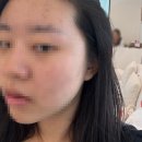 자나라인 | [ 강남 헤어라인 ] 피시엘 코리아 2차 헤어라인 다듬은 솔직 후기