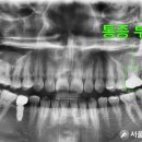 안아파치과의원 이미지