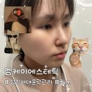 (주)엠케이 | 성신여대윤곽관리 엠케이에스테틱, 3cm리프팅 후기