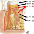 치아가 시리다면? 시린이의 원인과 치료 및 예방법 그리고 칫솔질 이미지