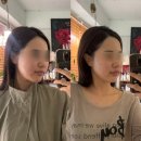 대전백운초교 | 대전 피부관리 괴정동 고은테라피 윤곽관리 받은 후기