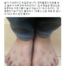 다들 여름 피부병 조심해.jpg 이미지