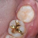 이스타치과기공소 이미지