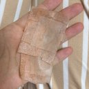 바른본외과의원 | [서울/압구정역] 양측성후천성오타양모반 치료 라움성형외과의원 2차후기